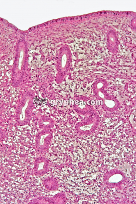 Endomètre prolifératif x25 - gryphea.org